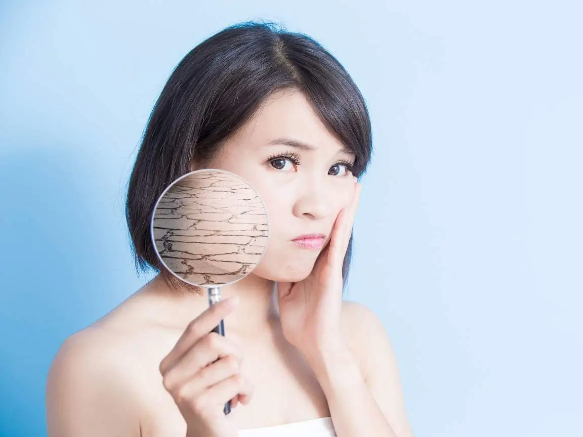 Száraz és repedezett arcbőr, amely Hydra Plus kezeléssel orvosolható