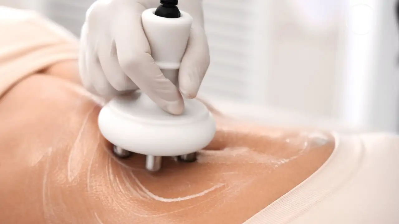 Rádiófrekvenciás testkezelés