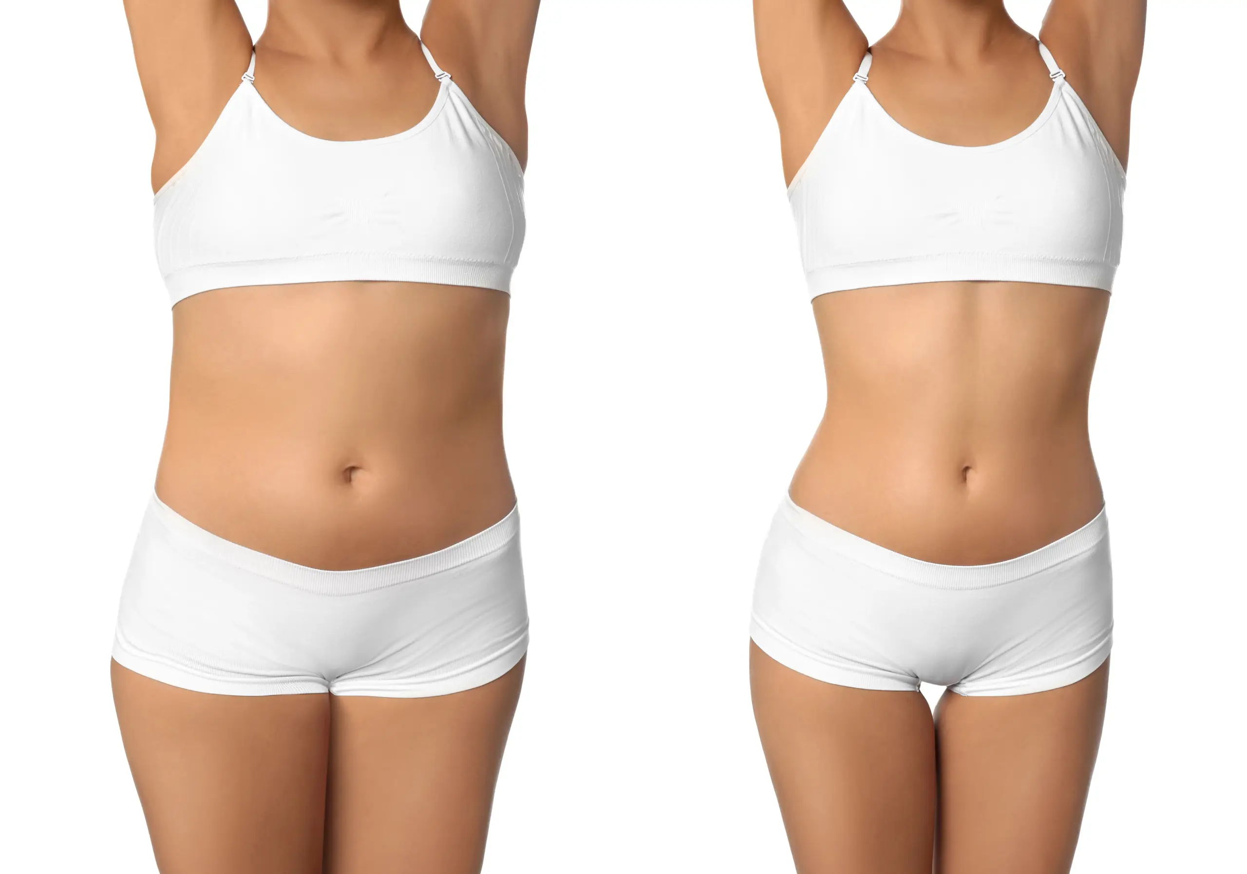 has, combok csökkentése, előtte és utána